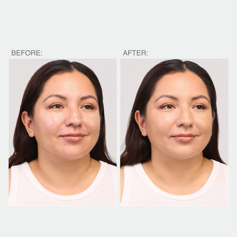 Woman's face, left shows blemishes labeled 'BEFORE:', right shows smoother skin labeled 'AFTER:' for spot-treat concealer