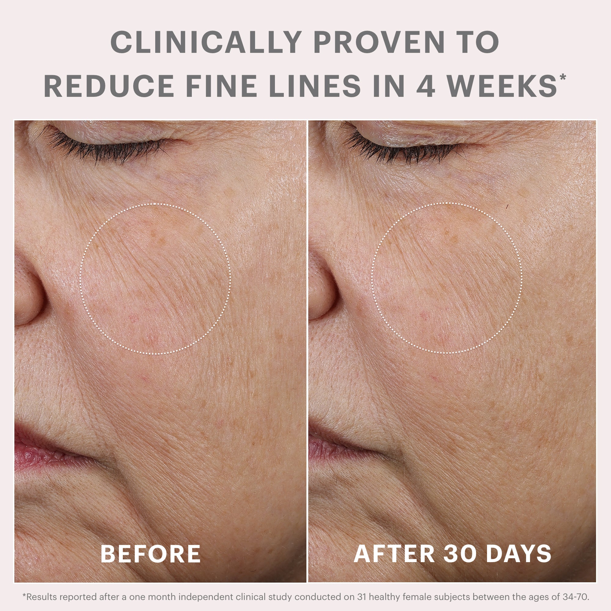 Bio-Renew EGF Rich Repair Cream