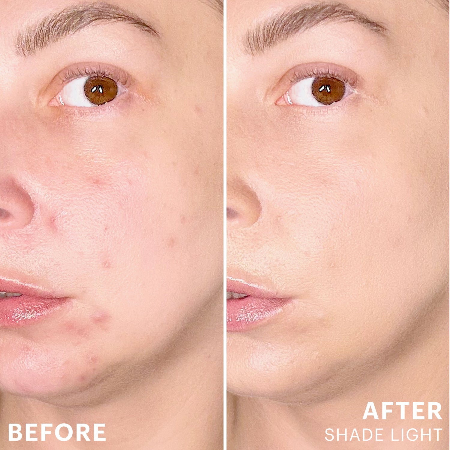 Spot Treat Concealer
