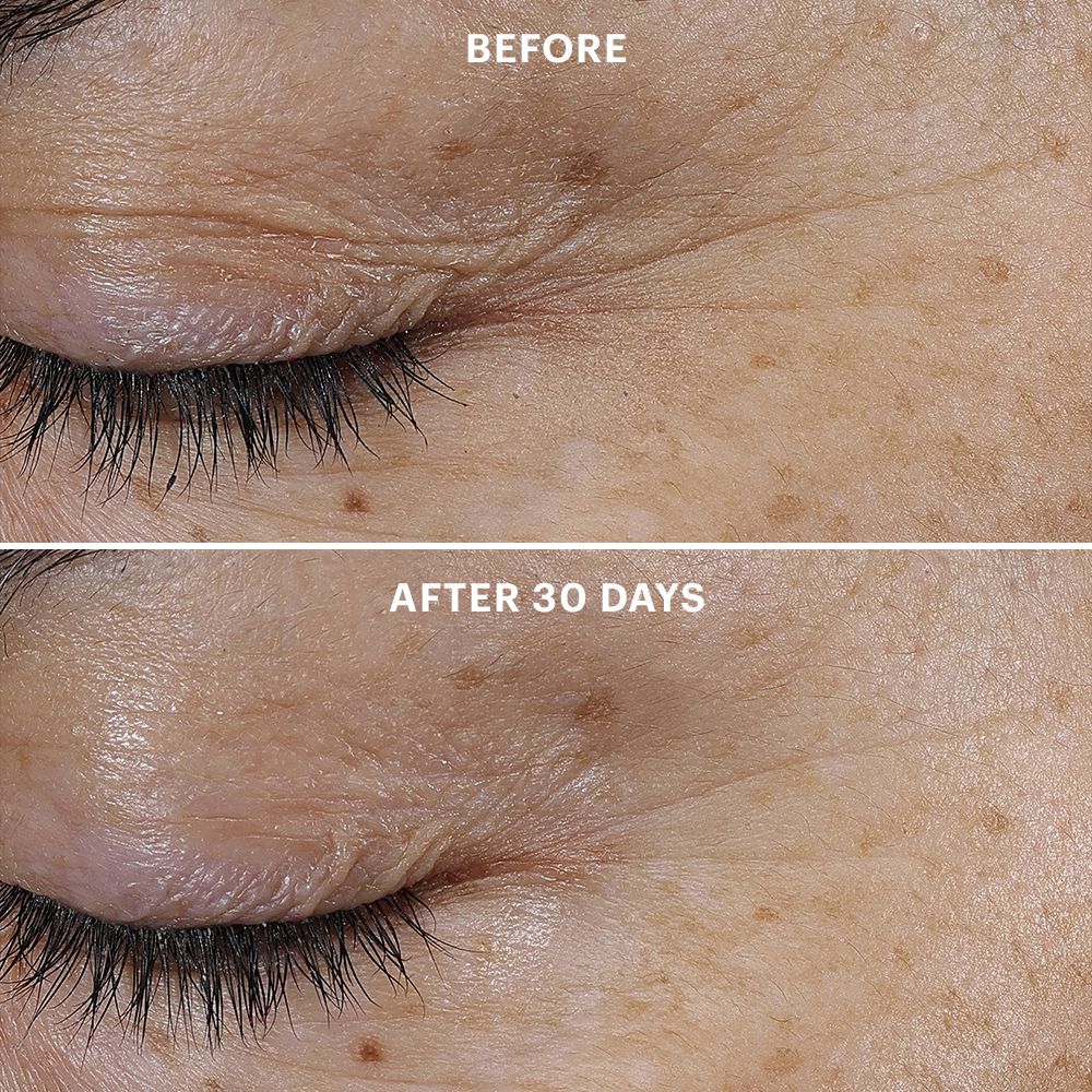 Bio-Renew EGF Eye Cream